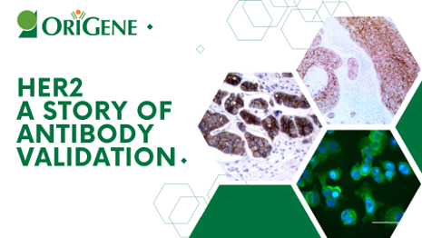 Our Her2 antibody validation story