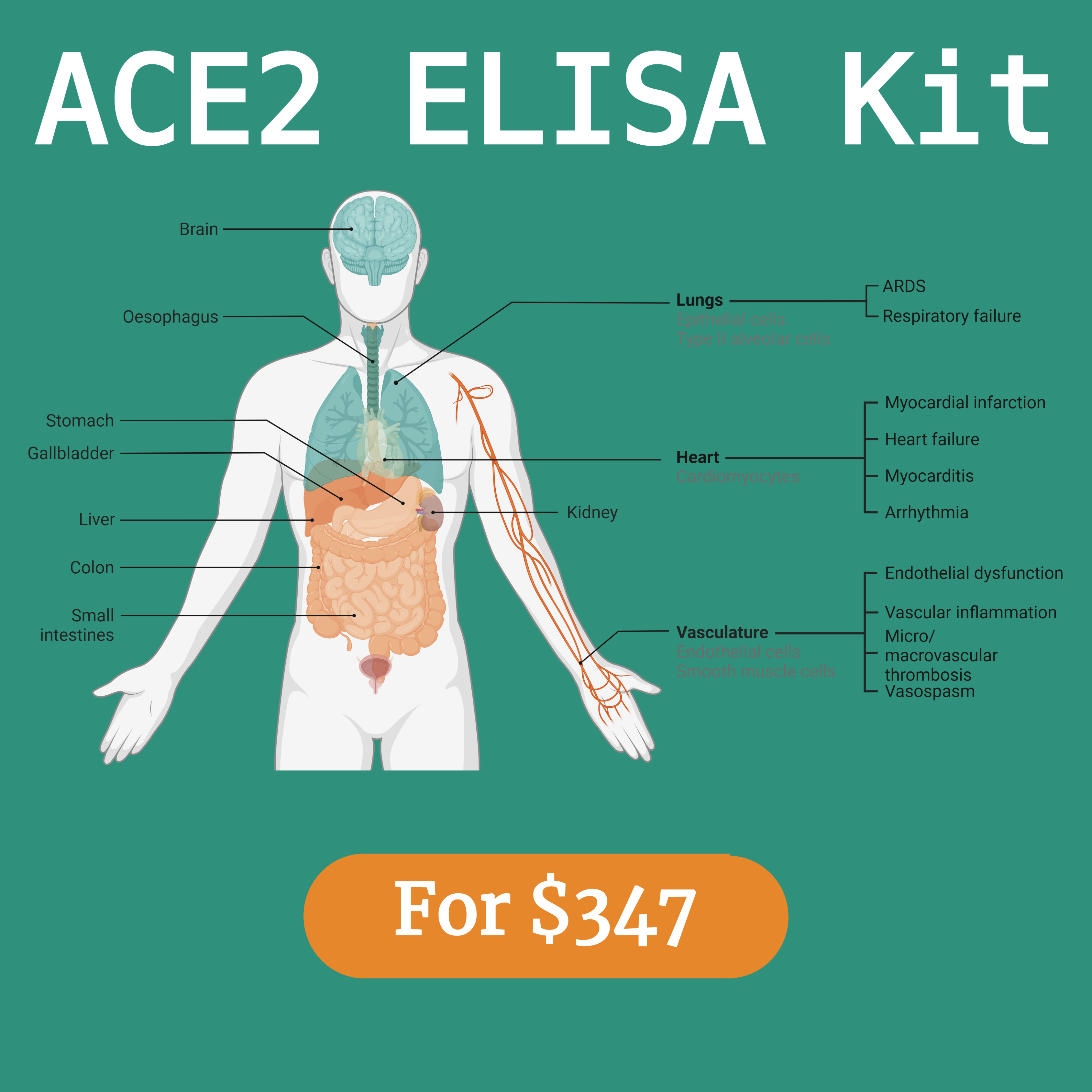 ACE2 ELISA Kit