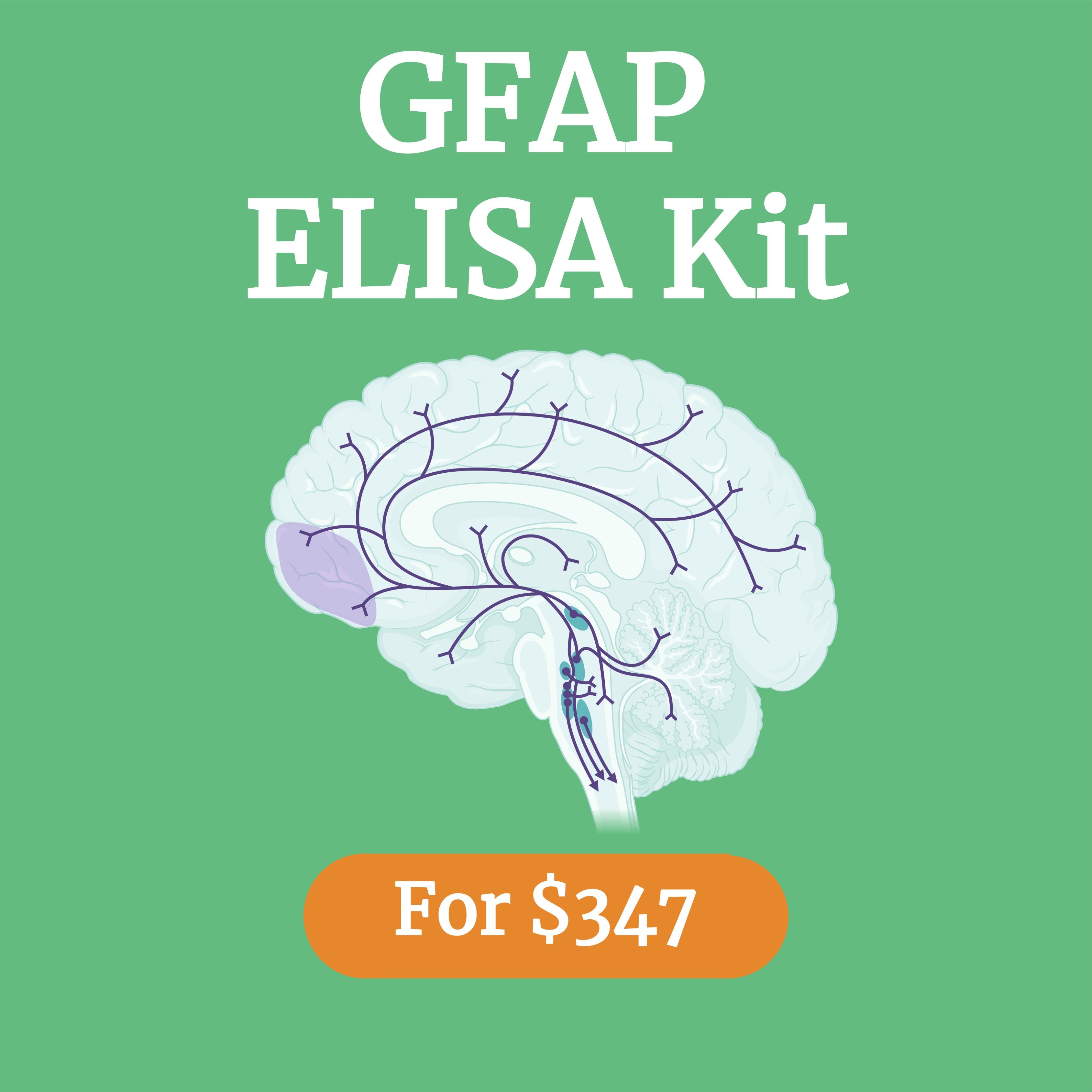 GFAP ELISA Kit