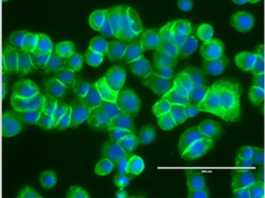 HT-29 cells stained
				for β-catenin with ultra specific antibody (UM500015)