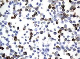 CD10 in MDA-MB-453 cell pellets stained with UM800128