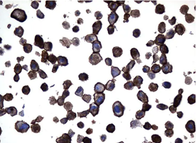 CD10 in SK-MEL-28 cell pellets stained with UM800127
