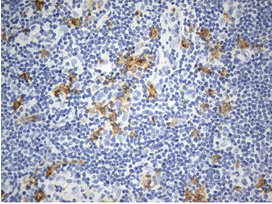 CD13 in Human Lymphoma tissue stained UM800165