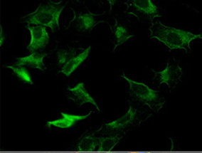 Cytokeratin 8 in A549 cells using UM500001