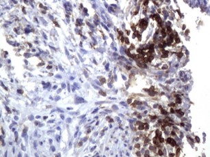 IHC staining anti-CD3E mouse monoclonal
        antibody