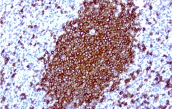 IHC staining anti-CD420 mouse monoclonal
            antibody