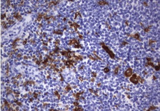 IHC staining anti-CD68 mouse monoclonal
            antibody