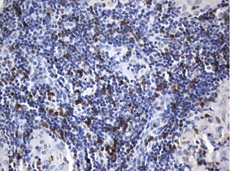 IHC staining anti-CD8A mouse monoclonal
            antibody