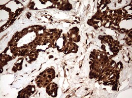 GAPDH IHC staining with anti-GAPDH mouse monoclonal antibody