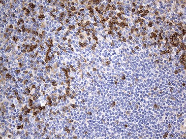 GAPDH IHC staining with anti-GAPDH mouse monoclonal antibody