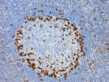 Immunohistochemical staining of FFPE human tonsil using anti-PD1