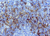 Human tonsil stained with anti-CD1C mouse monoclonal antibody (UM500042)